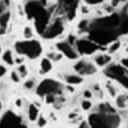 DEXA scan (low-dose radiation)