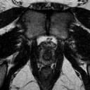 Geschlechtsgesundheit (Prostata oder Eierstöcke)