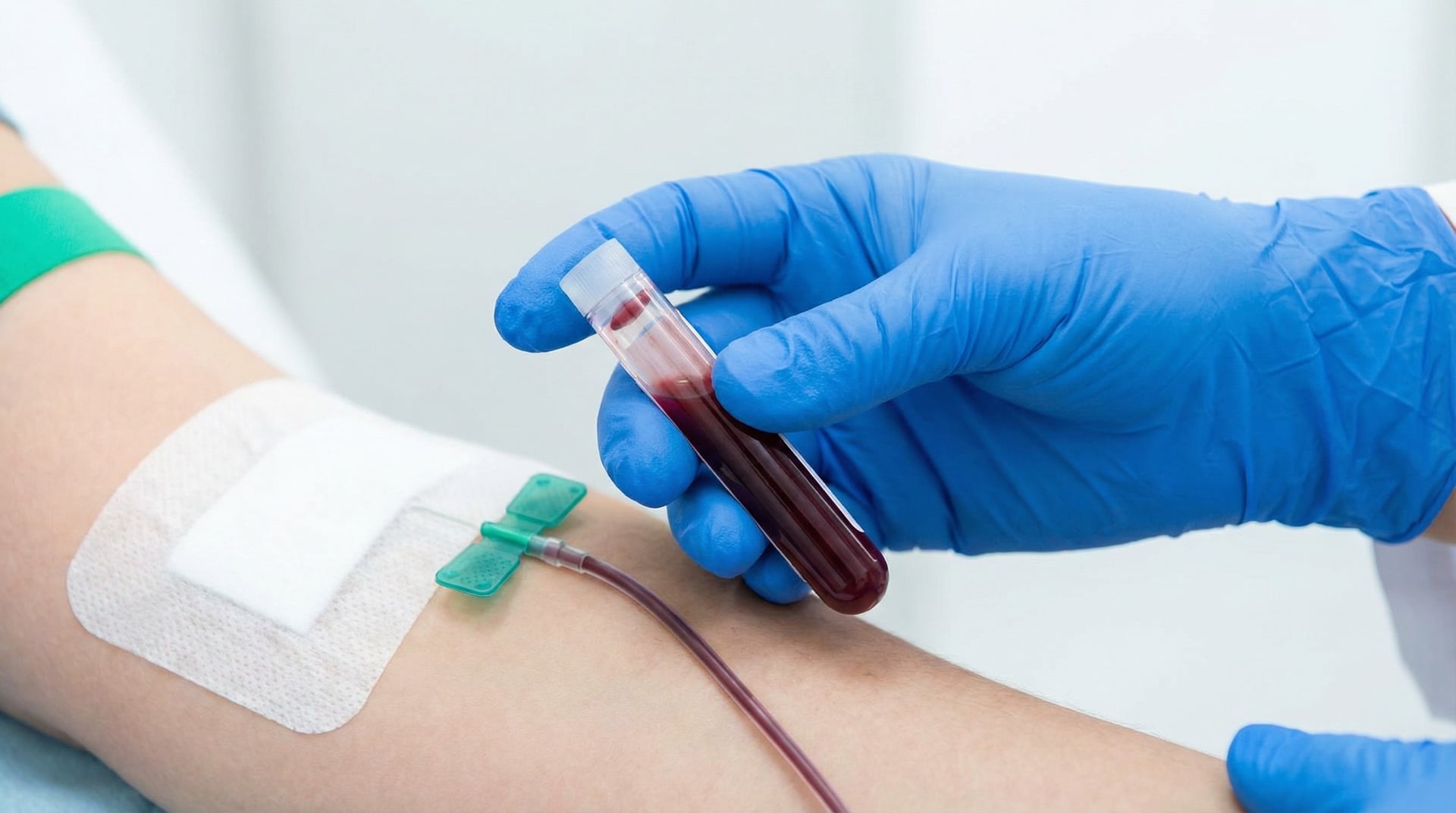 Gloved hand holding a vial of dark red blood next to a patient's bandaged arm during a venous draw
