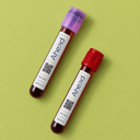 Essential B-vitamins blood test