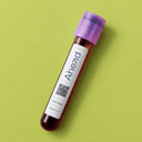Lipoprotein (a) blood test